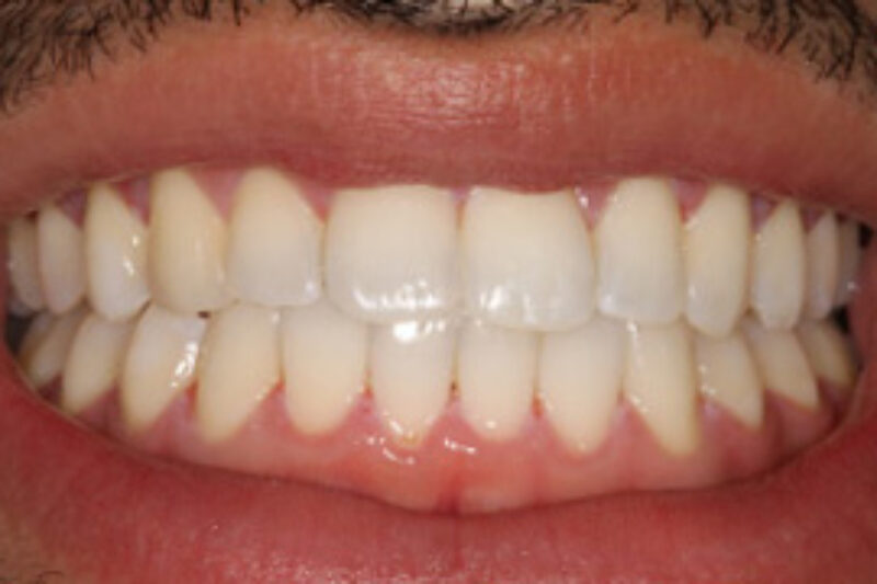 After - Cheadle Hulme Dental