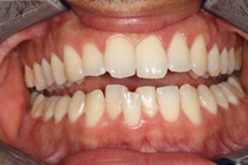 Before - Cheadle Hulme Dental