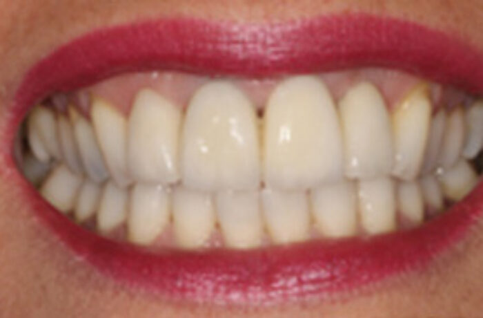 After - Cheadle Hulme Dental