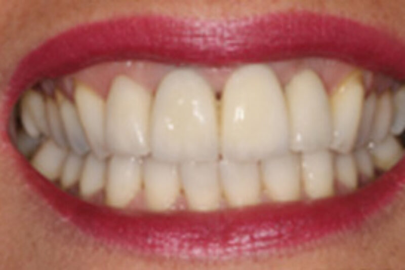 After - Cheadle Hulme Dental