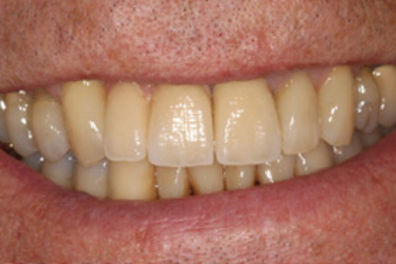 After - Cheadle Hulme Dental