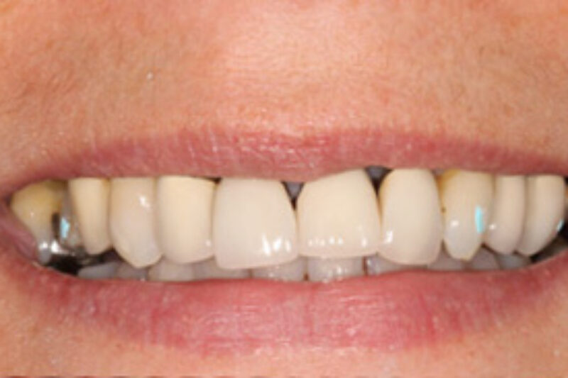 Before - Cheadle Hulme Dental