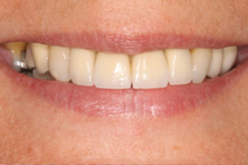 After - Cheadle Hulme Dental