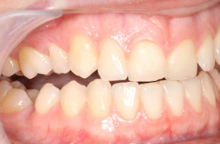 Before - Cheadle Hulme Dental