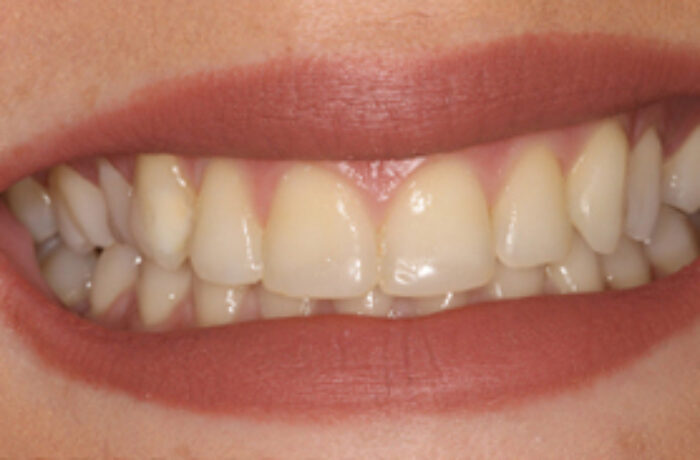 After - Cheadle Hulme Dental