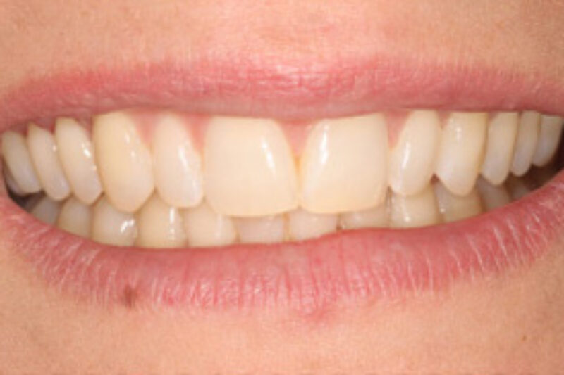 After - Cheadle Hulme Dental