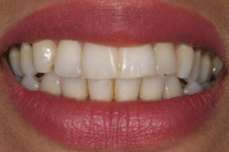 After - Cheadle Hulme Dental