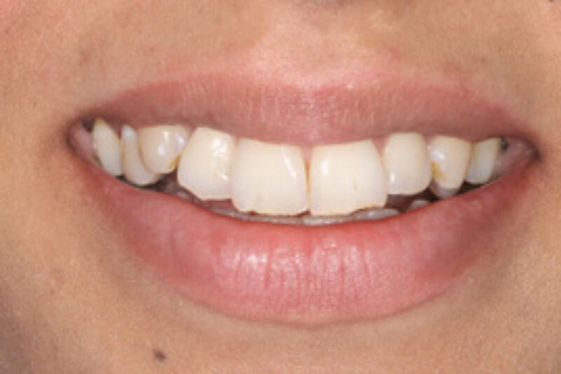 Before - Cheadle Hulme Dental