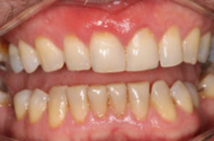 Before - Cheadle Hulme Dental