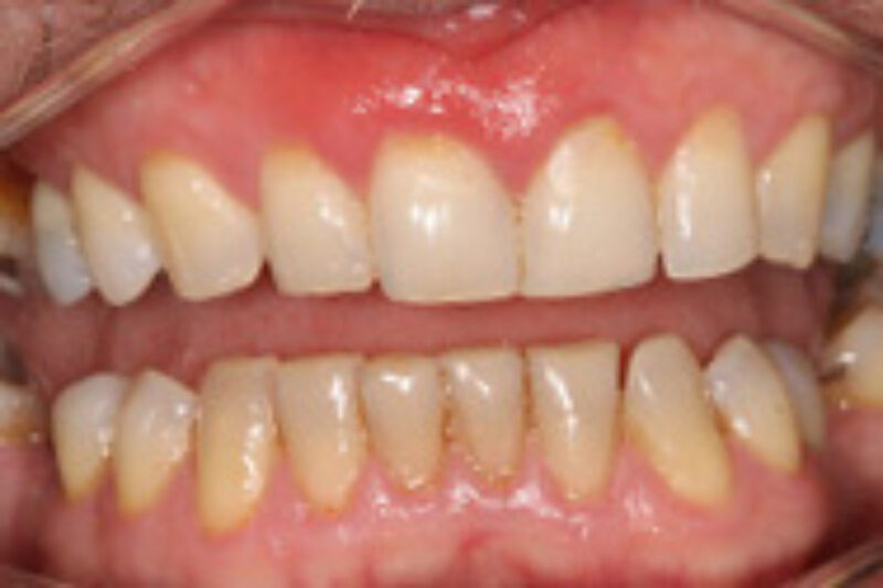 Before - Cheadle Hulme Dental