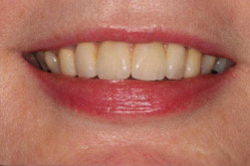 After - Cheadle Hulme Dental