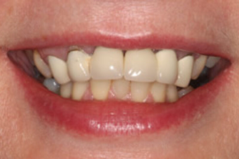 Before - Cheadle Hulme Dental