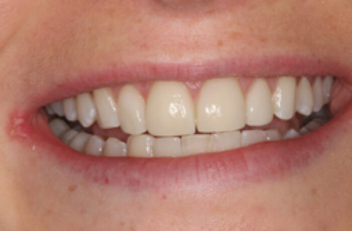 After - Cheadle Hulme Dental