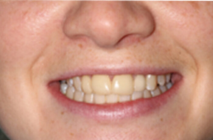 Before - Cheadle Hulme Dental