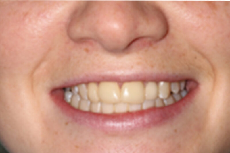 Before - Cheadle Hulme Dental