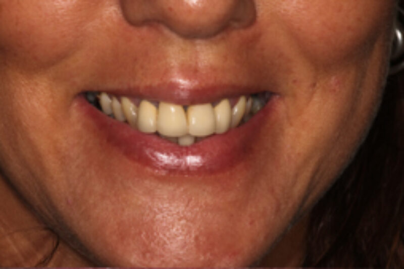 Before - Cheadle Hulme Dental