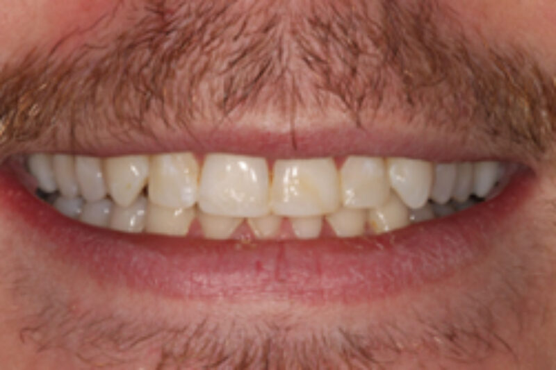 After - Cheadle Hulme Dental