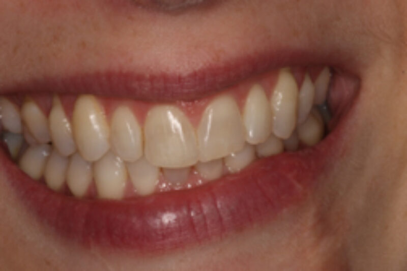 After - Cheadle Hulme Dental