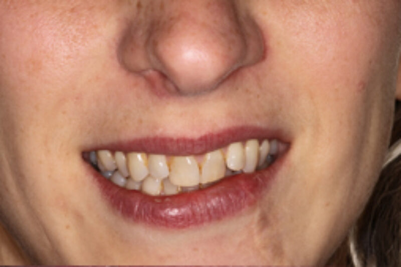 Before - Cheadle Hulme Dental