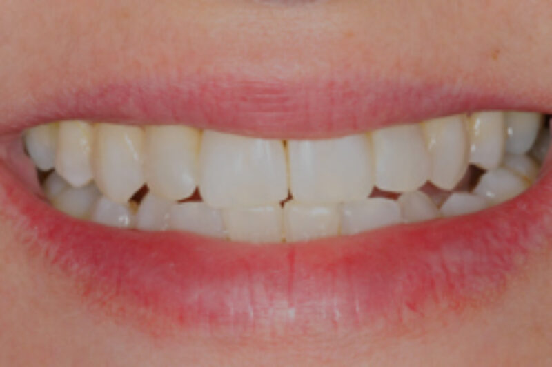 After - Cheadle Hulme Dental