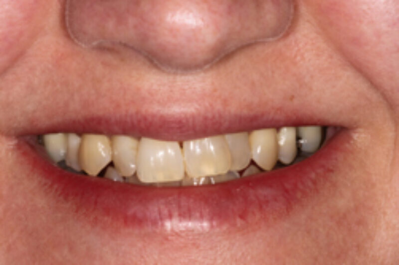 Before - Cheadle Hulme Dental