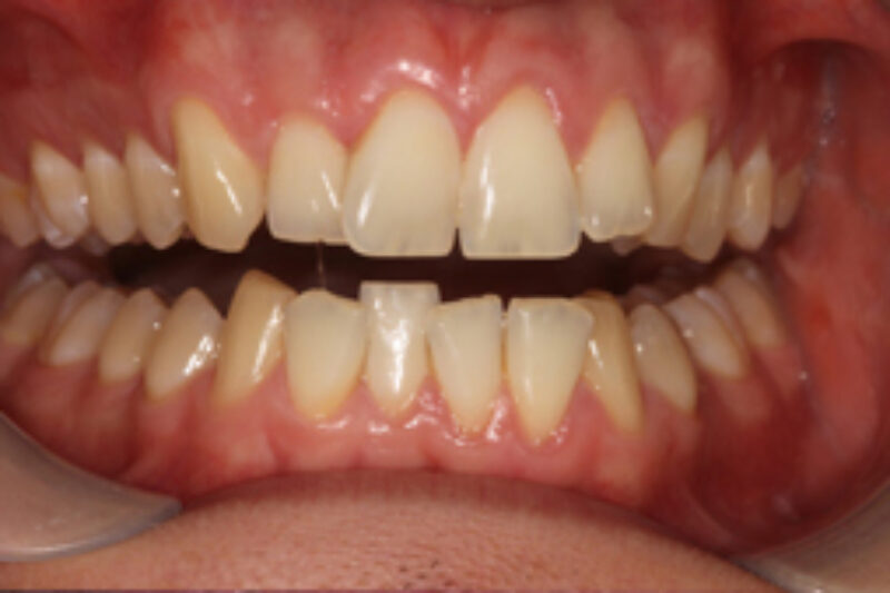 Before - Cheadle Hulme Dental