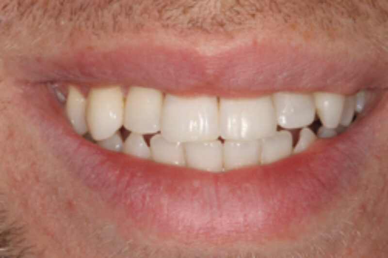 After - Cheadle Hulme Dental