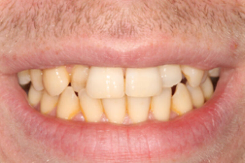 Before - Cheadle Hulme Dental