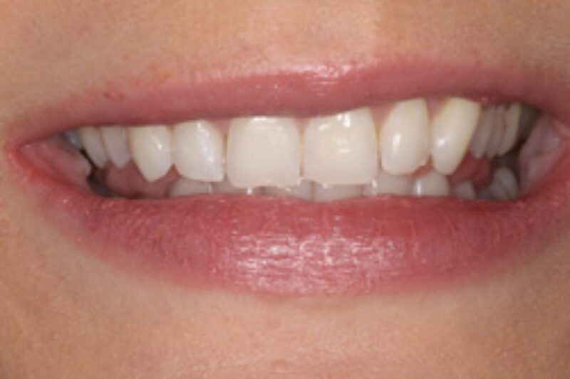 After - Cheadle Hulme Dental