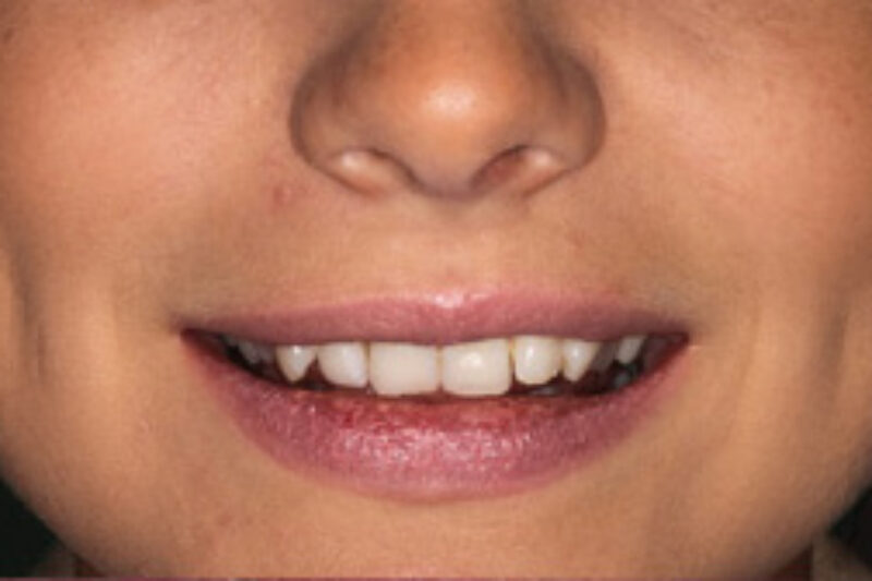 Before - Cheadle Hulme Dental