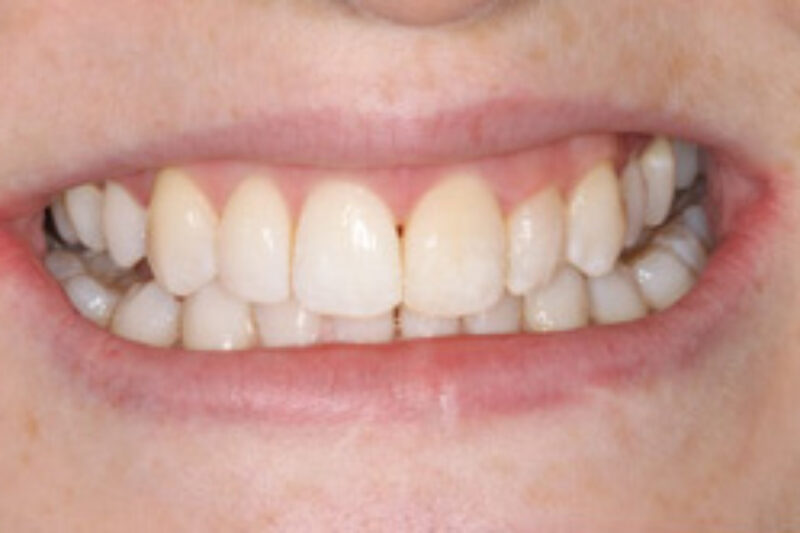 After - Cheadle Hulme Dental