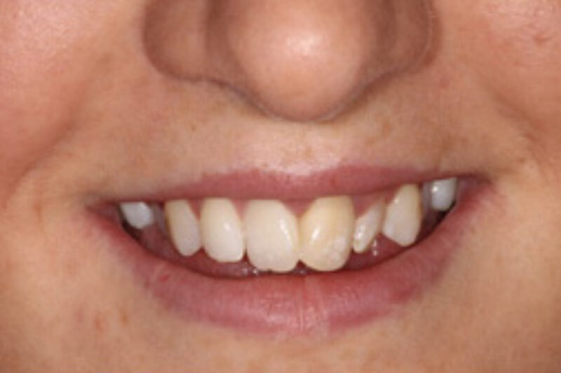 Before - Cheadle Hulme Dental