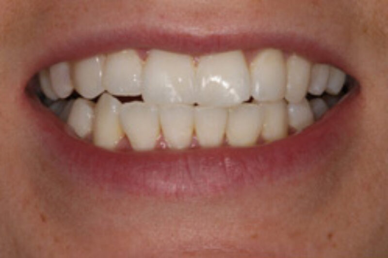 After - Cheadle Hulme Dental