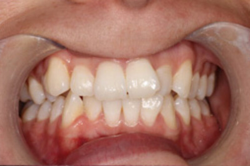 Before - Cheadle Hulme Dental