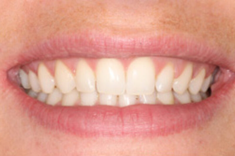 After - Cheadle Hulme Dental