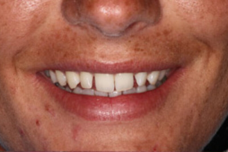 Before - Cheadle Hulme Dental