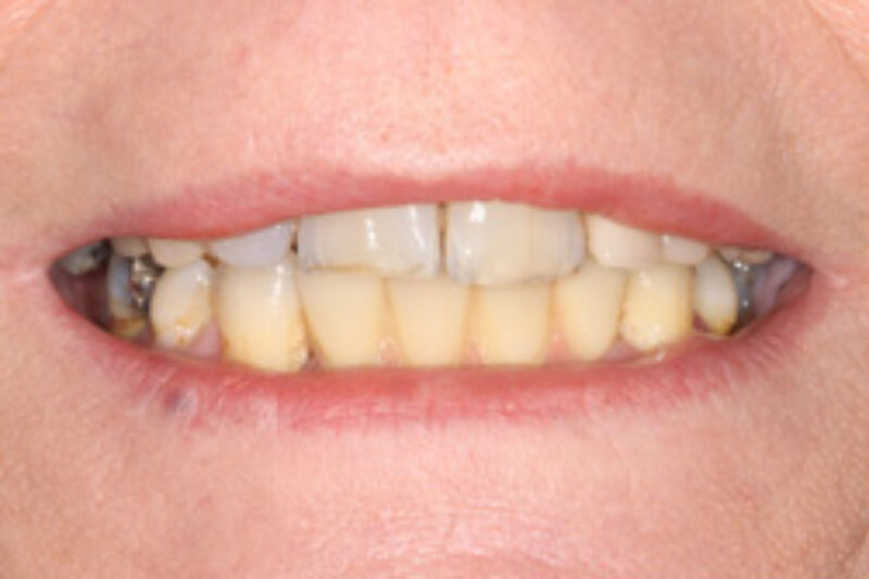 After - Cheadle Hulme Dental