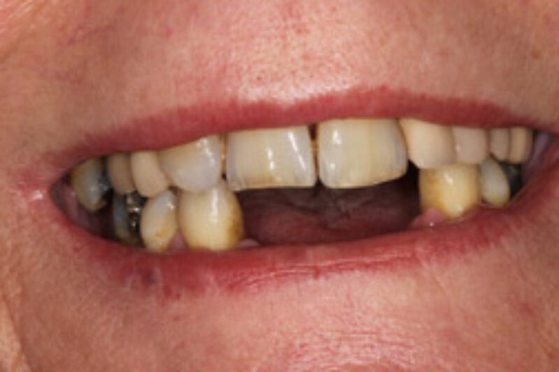 Before - Cheadle Hulme Dental