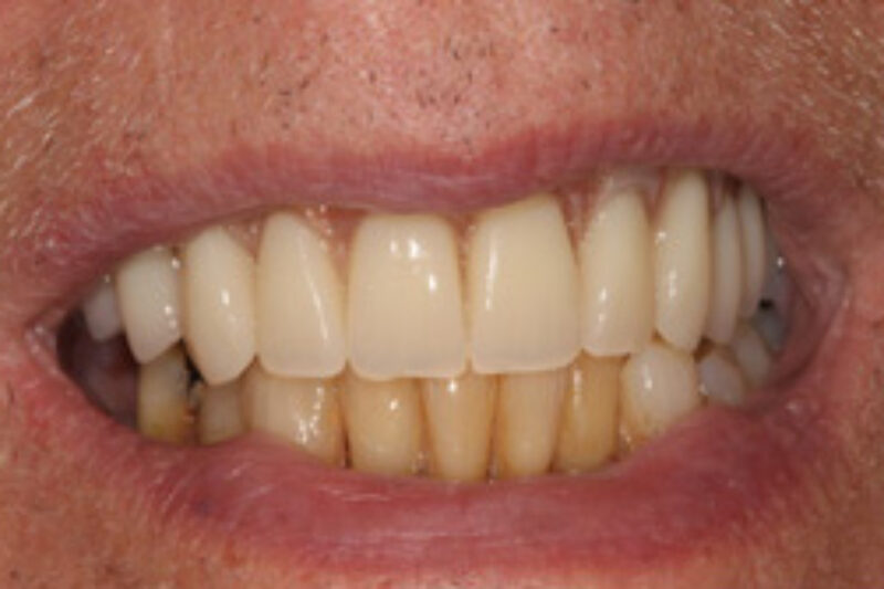 After - Cheadle Hulme Dental