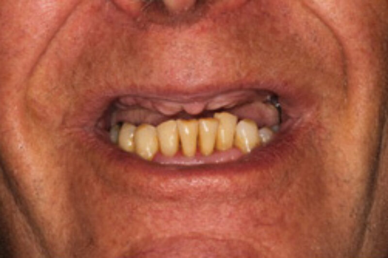 Before - Cheadle Hulme Dental