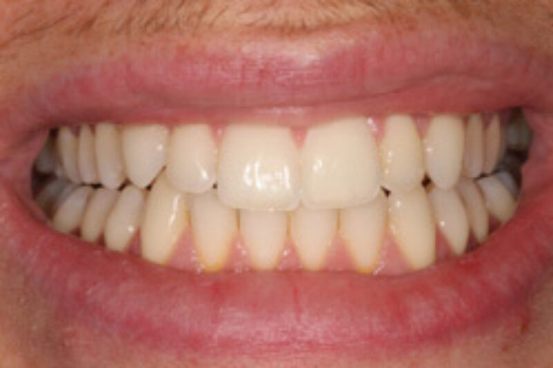 After - Cheadle Hulme Dental