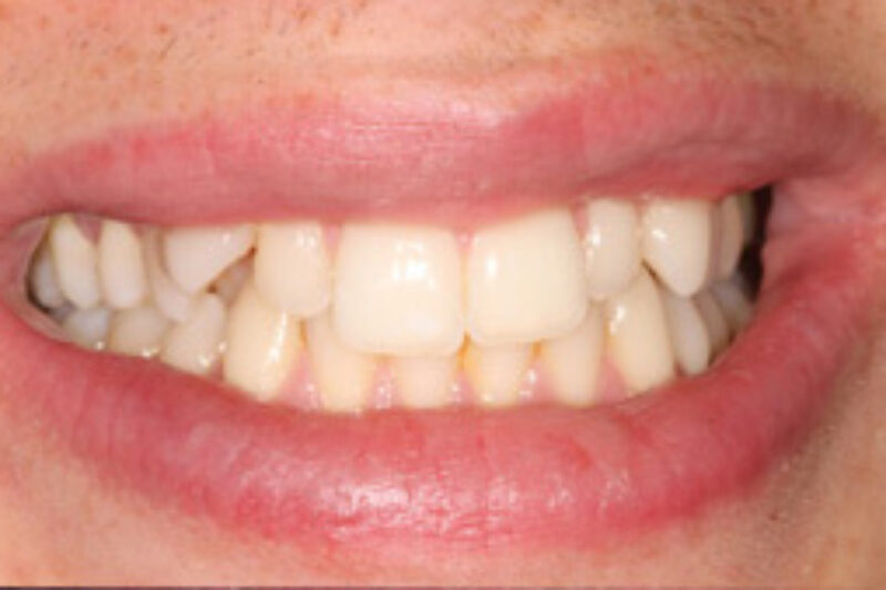 Before - Cheadle Hulme Dental