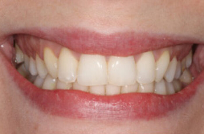 After - Cheadle Hulme Dental