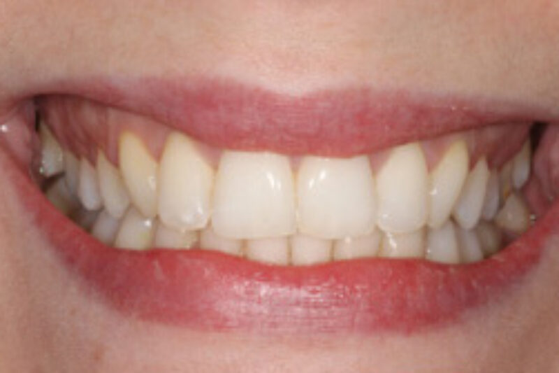 After - Cheadle Hulme Dental