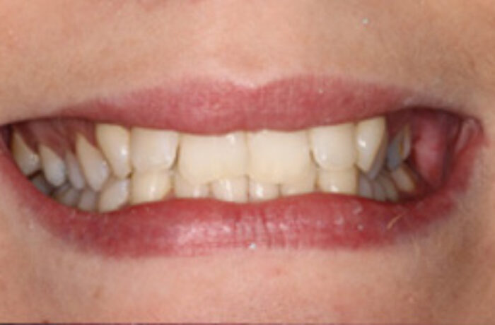 Before - Cheadle Hulme Dental