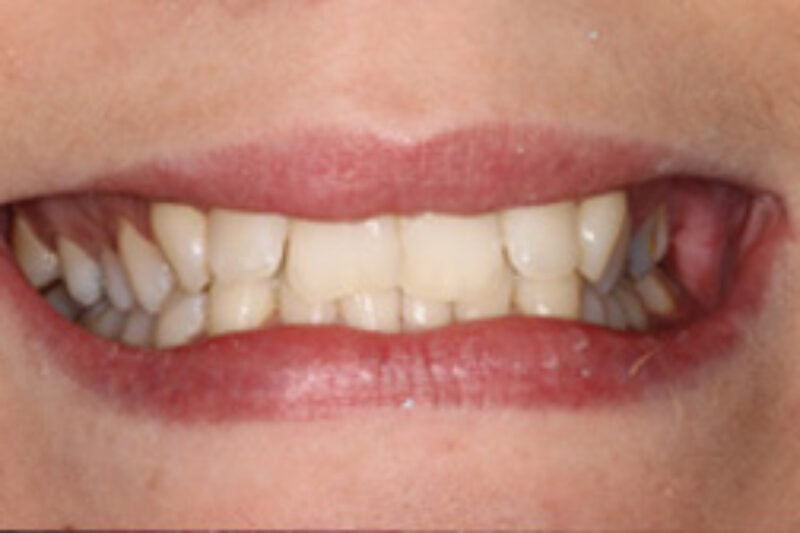 Before - Cheadle Hulme Dental