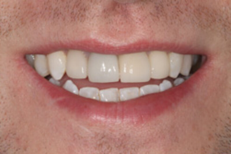 After - Cheadle Hulme Dental