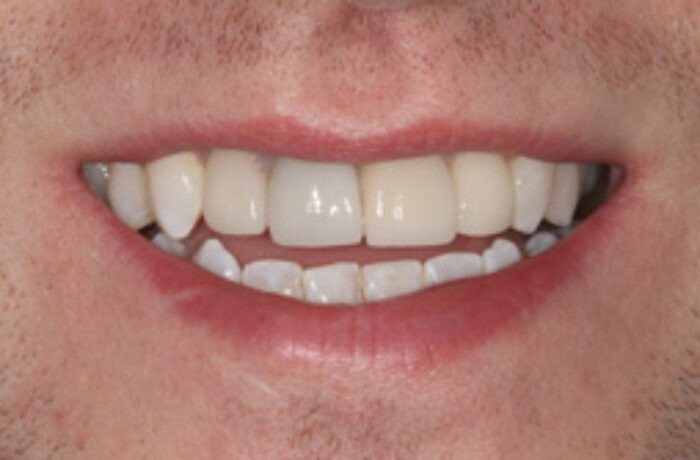 After - Cheadle Hulme Dental