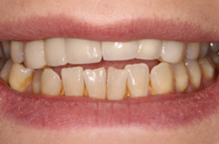 Before - Cheadle Hulme Dental