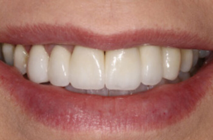 After - Cheadle Hulme Dental